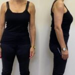 Success of Metabolic Balance Program
